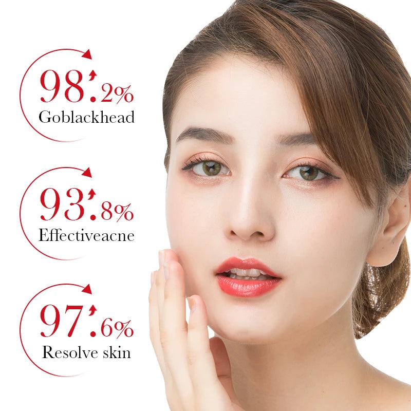 ZeroZit: The Blemish Blitz Potion - By Oracitive™